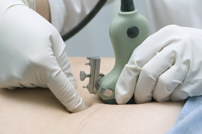 Wat is een vruchtwaterpunctie?